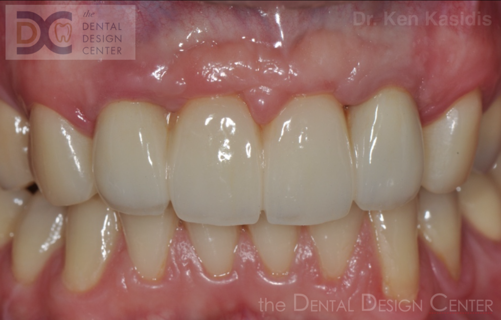 Dentalimplantdentalclinicpattaya1 1024x655 1
