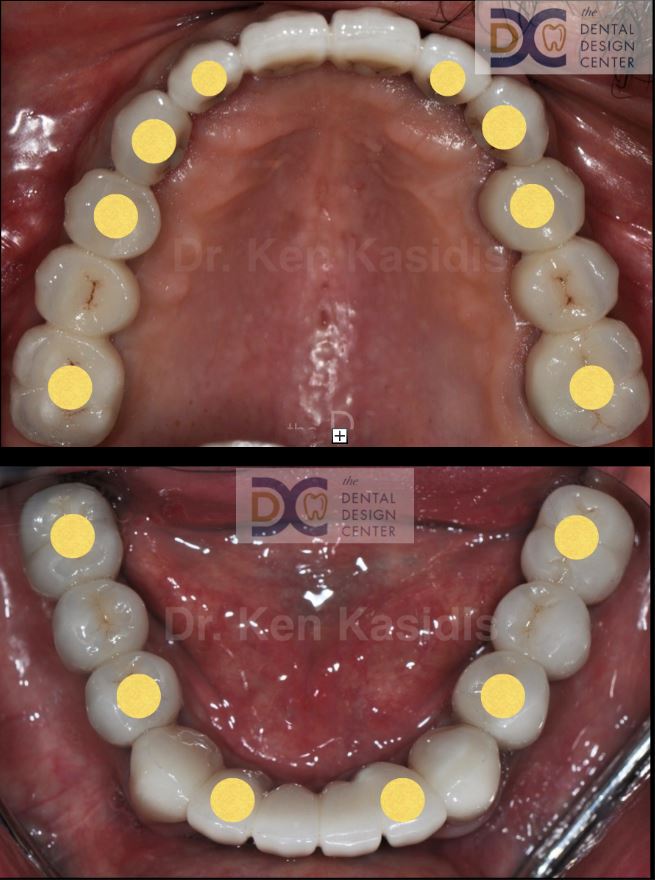 dental treatment pattaya dentist 9