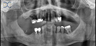 dental20x ray20pattaya2001