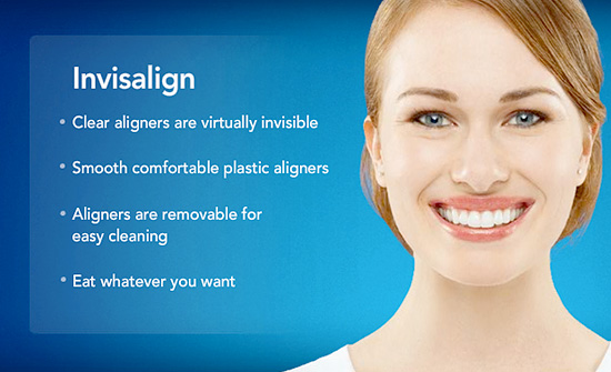 invisalign2