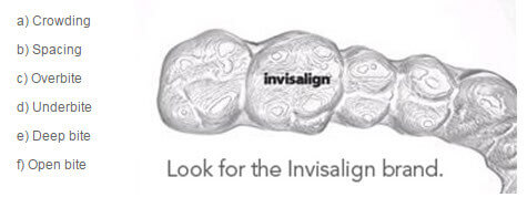 invisalign lookfor