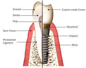 orthosmile sr dental imgb