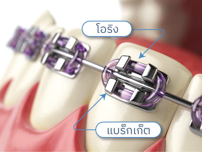 ยางเชน กับ ยางโอริง ต่างกันยังไง️? - Dental Design Pattaya