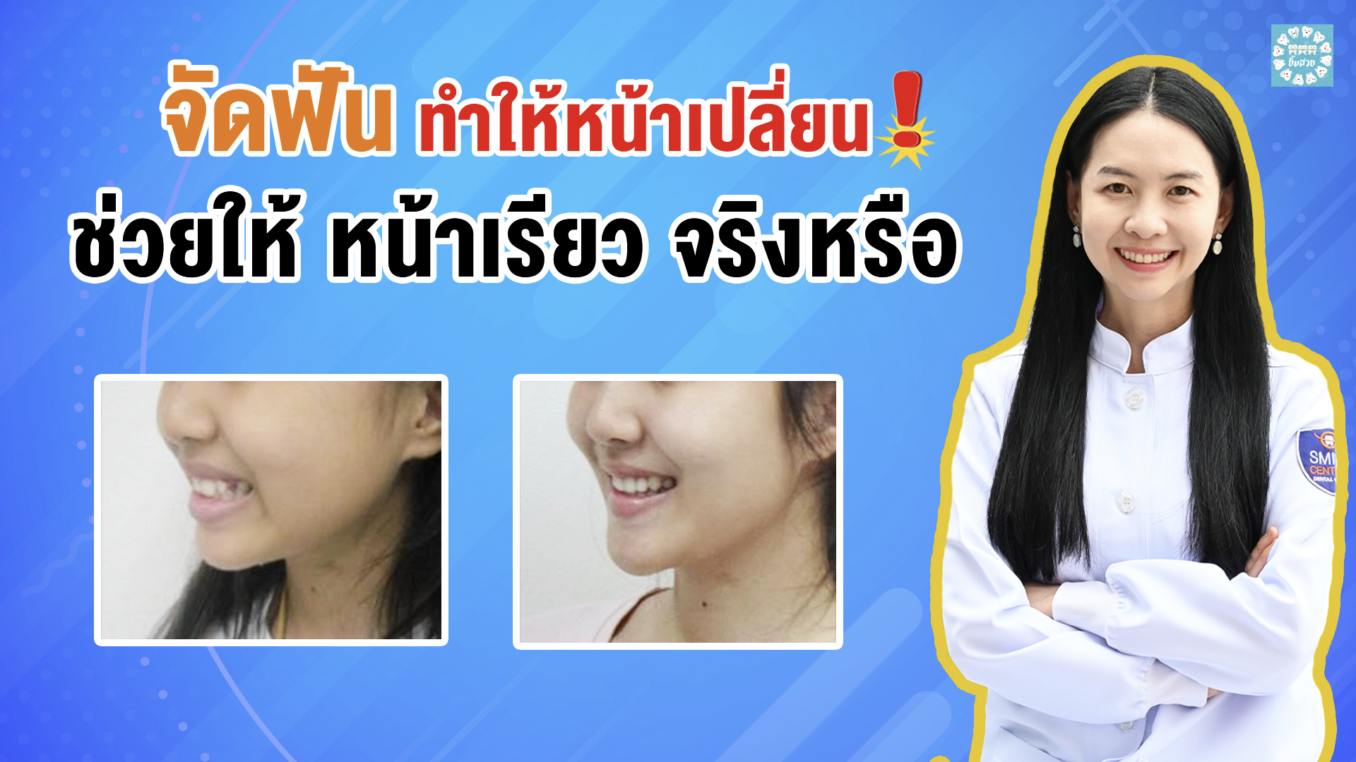 จัดฟัน ทำให้หน้าเปลี่ยน ช่วยให้ หน้าเรียว จริงหรือ!! Dental Design