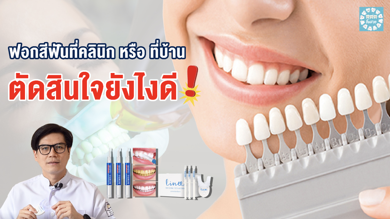 ฟอกสีฟันที่บ้าน กับ ที่คลินิกต่างกันยังไง Dental Design Pattaya