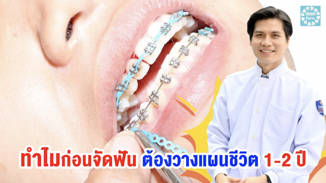 ทำไมก่อนจัดฟันต้องวางแผนชีวิต 12 ปี อย่าเพิ่งจัดฟันถ้ายังไม่รู้เรื่อง