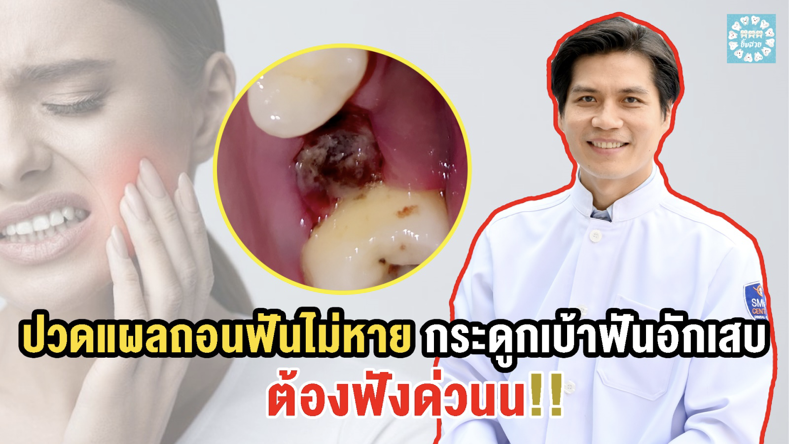 ปวดแผลถอนฟันไม่หาย กระดูกเบ้าฟันอักเสบ - Dental Design Pattaya