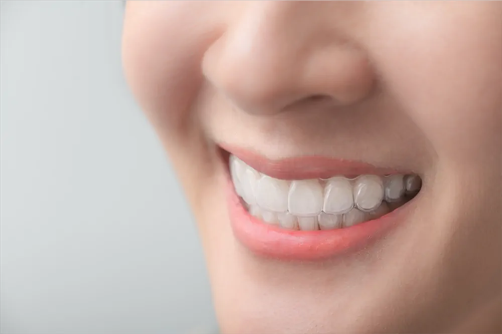 09 different types of braces for teeth