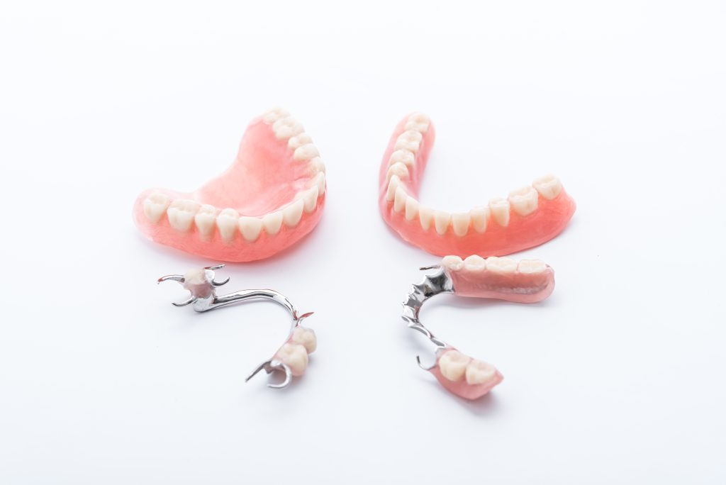 02 what is the difference between dentures and implants