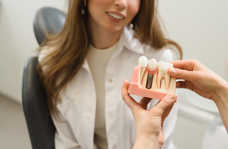 ฟันปลอมกับรากฟันเทียม ต่างกันอย่างไร? ควรเลือกแบบไหนถึงใช่มากที่สุด