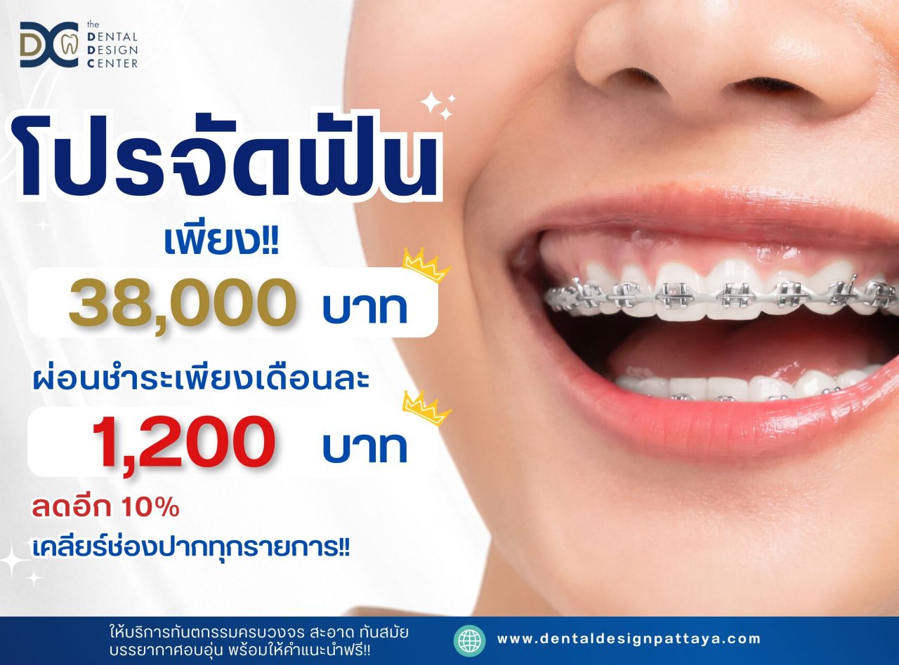 Dental Clinic Pattaya at Dental Design Center Pattaya