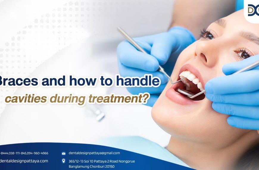 Braces and how to handle cavities during treatment?