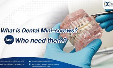 What is dental mini-screws And who need them