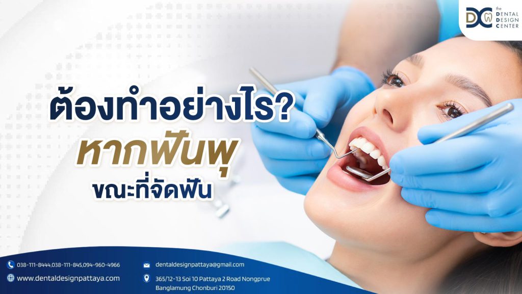 ต้องทำอย่างไร หากฟันผุขณะที่จัดฟัน.