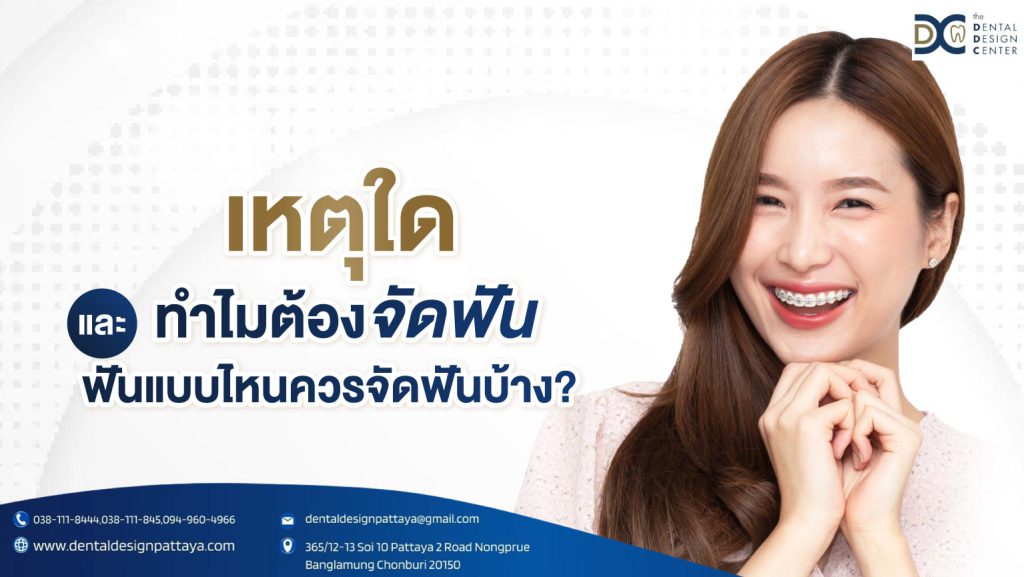 เหตุใด ทำไมต้องจัดฟัน และฟันแบบไหนควรจัดฟันบ้าง