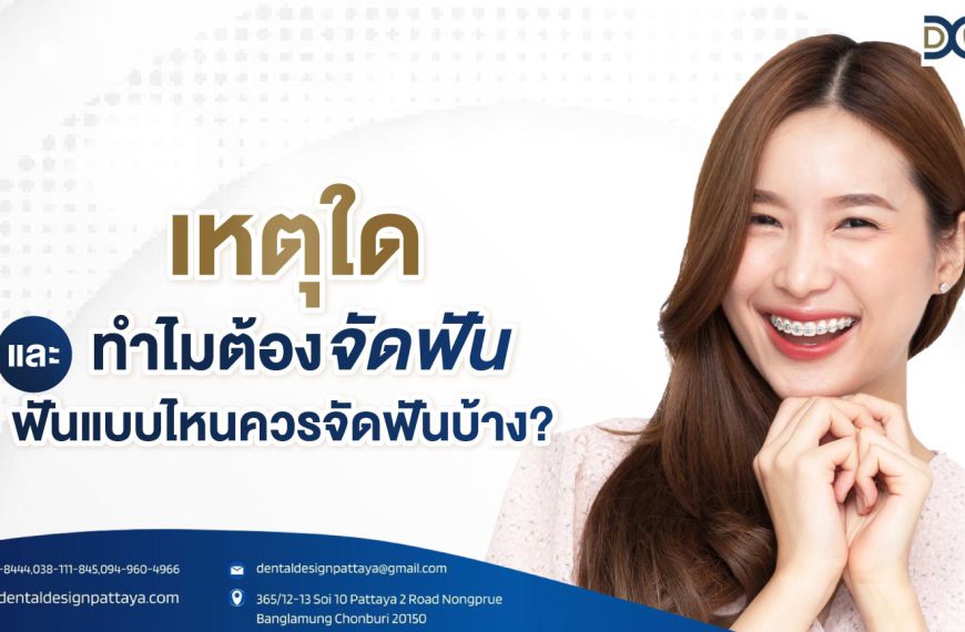 เหตุใด ทำไมต้องจัดฟัน และฟันแบบไหนควรจัดฟันบ้าง