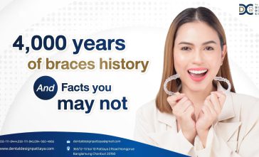 4,000 years of braces history and facts you may not know