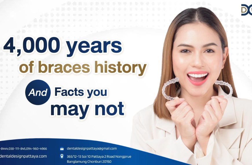 4,000 years of braces history and facts you may not know