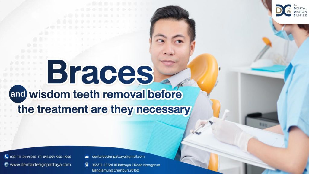 Braces and wisdom teeth removal before the treatment are they necessary