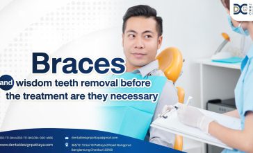 Braces and wisdom teeth removal before the treatment are they necessary