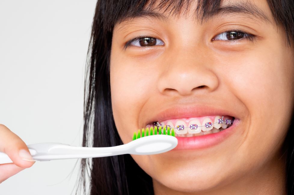 How to clean your mouth and teeth while Braces