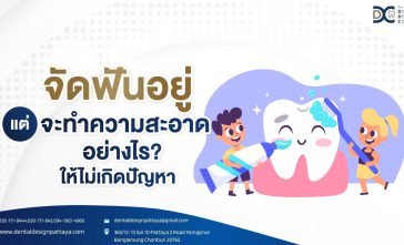 จัดฟันอยู่ แต่จะทำความสะอาดอย่างไรให้ไม่เกิดปัญหา