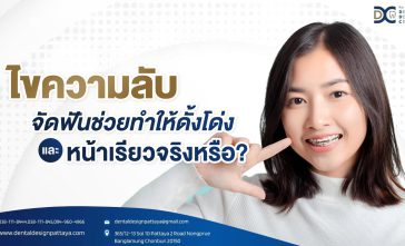 ไขความลับ จัดฟันช่วยทำให้ดั้งโด่งและหน้าเรียวจริงหรือ