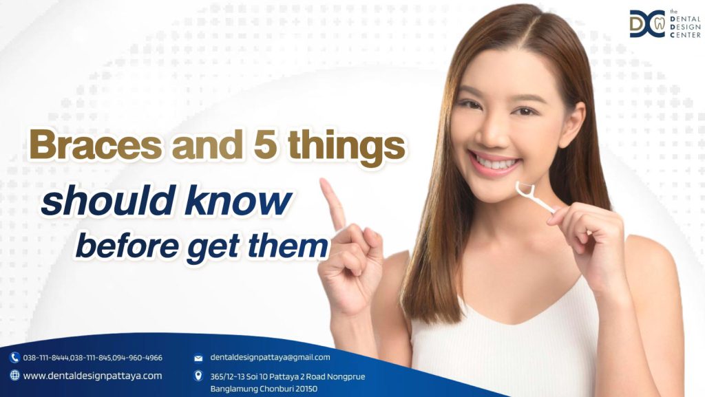 Braces and 5 things should know before get them