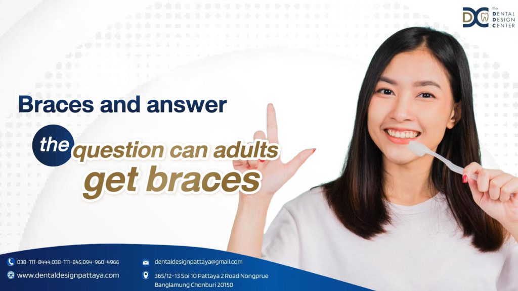 Braces and answer the question can adults get braces