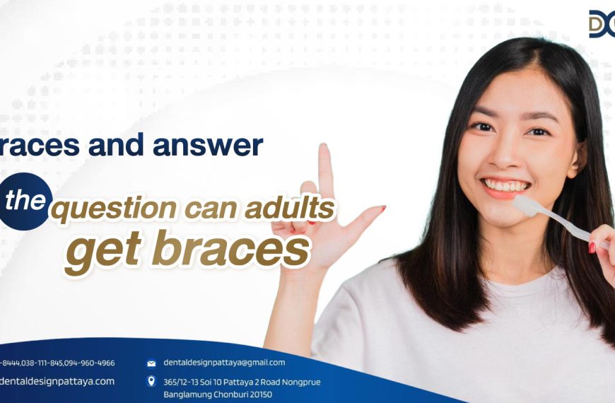 Braces and answer the question can adults get braces