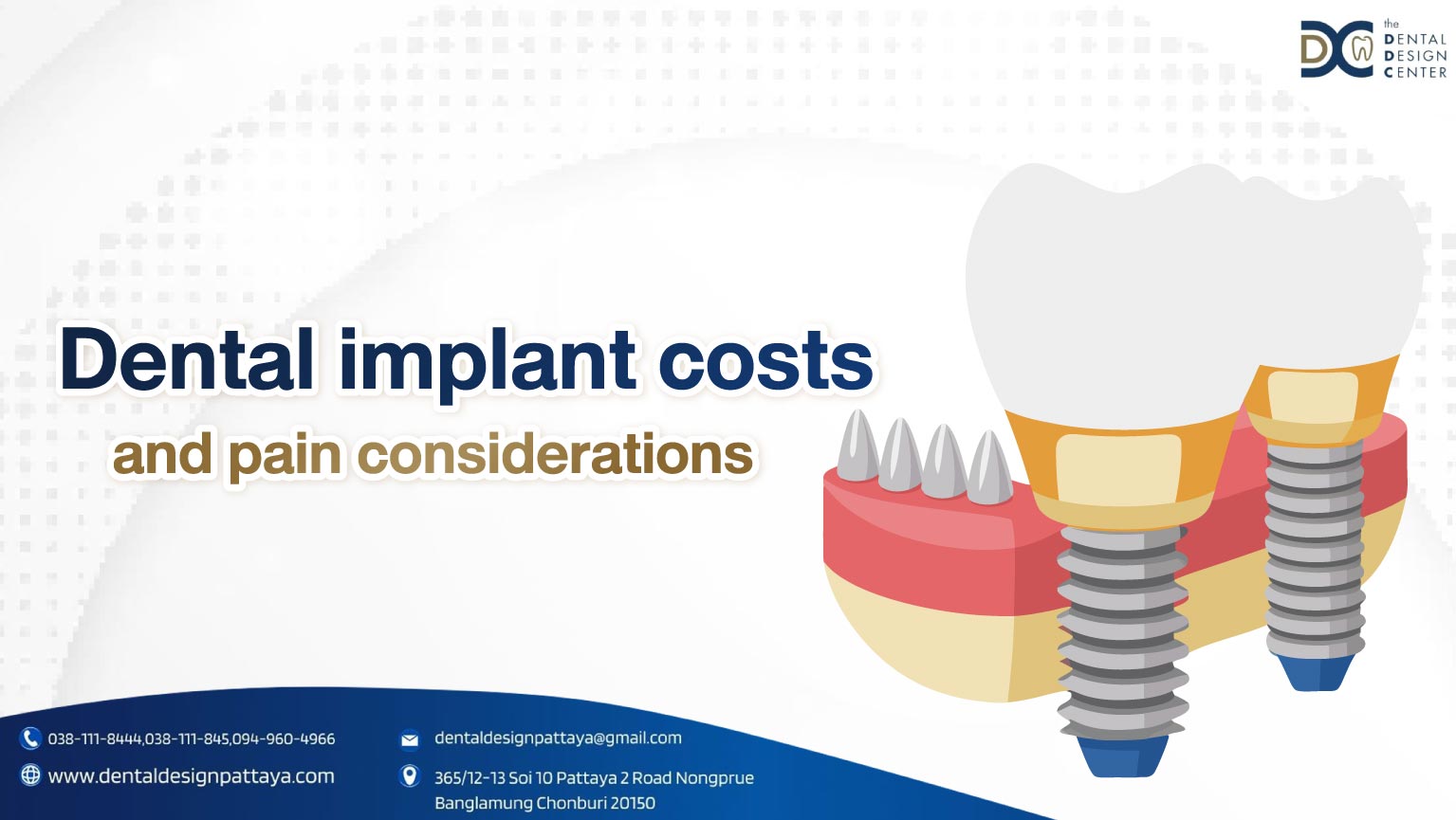 Dental implant costs and pain considerations