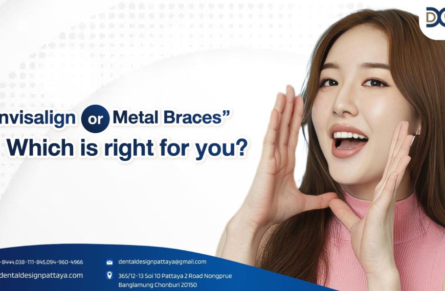 “Invisalign or Metal Braces” Which is right for you