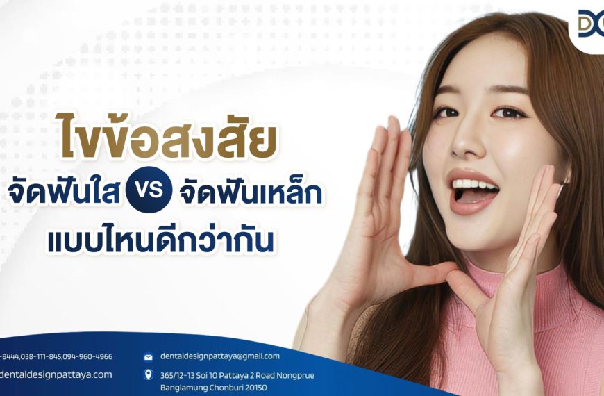 ไขข้อสงสัย จัดฟันใส vs จัดฟันเหล็ก แบบไหนดีกว่ากัน