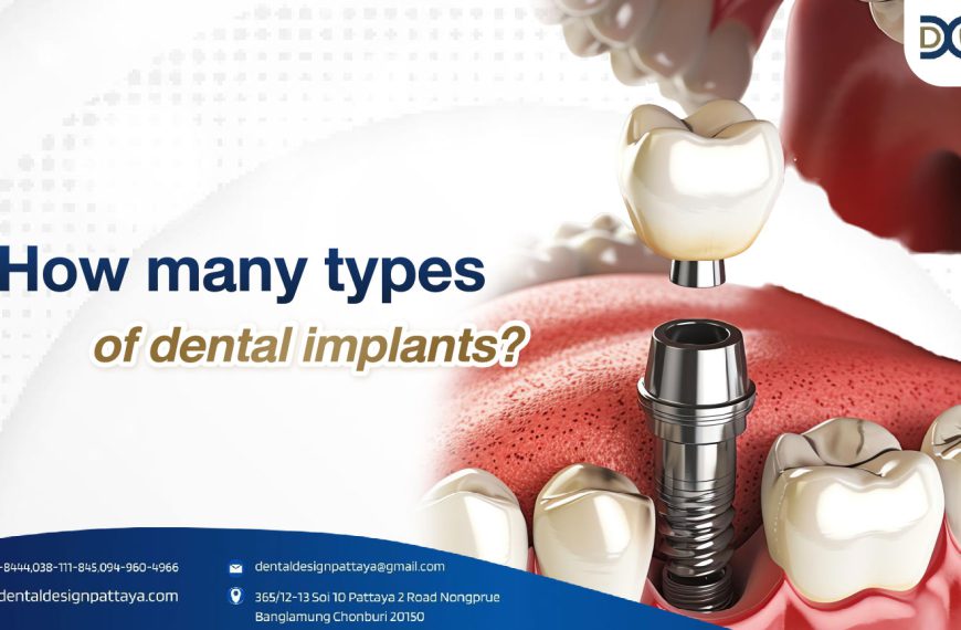 How many types of dental implants