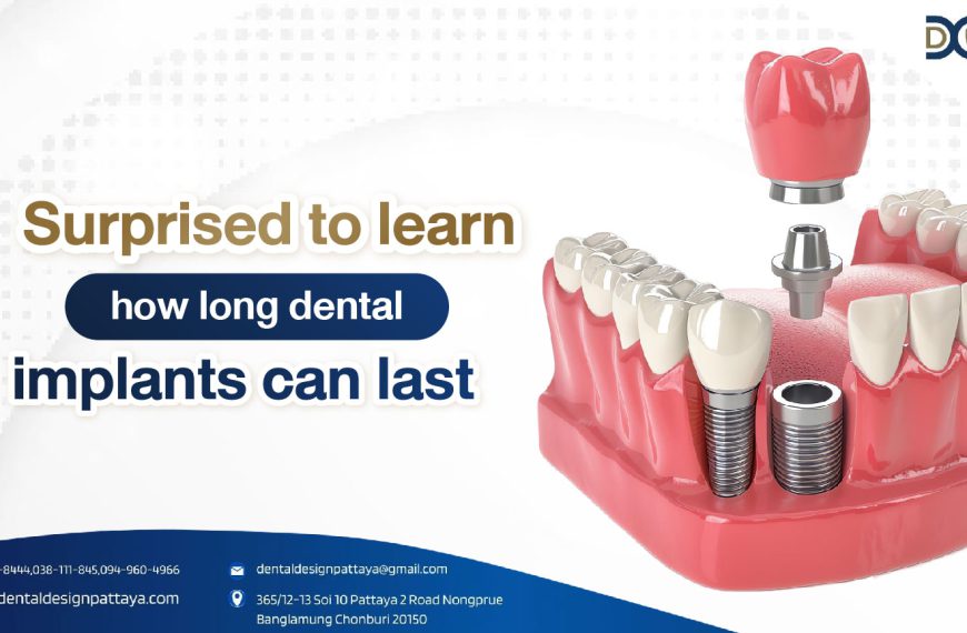 Surprised to learn how long dental implants can last