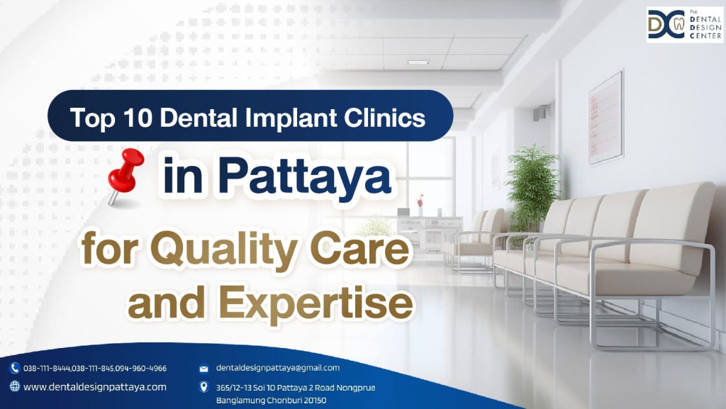 Top 10 Dental Implant Clinics in Pattaya for Quality Care and Expertise