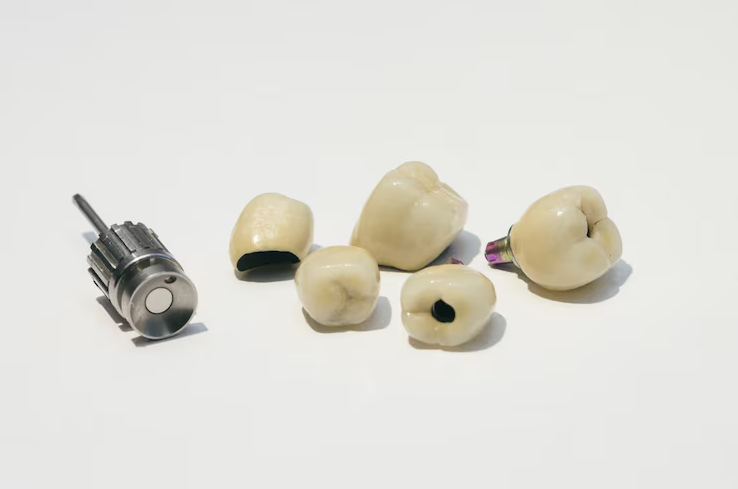 Types of Dental Implants