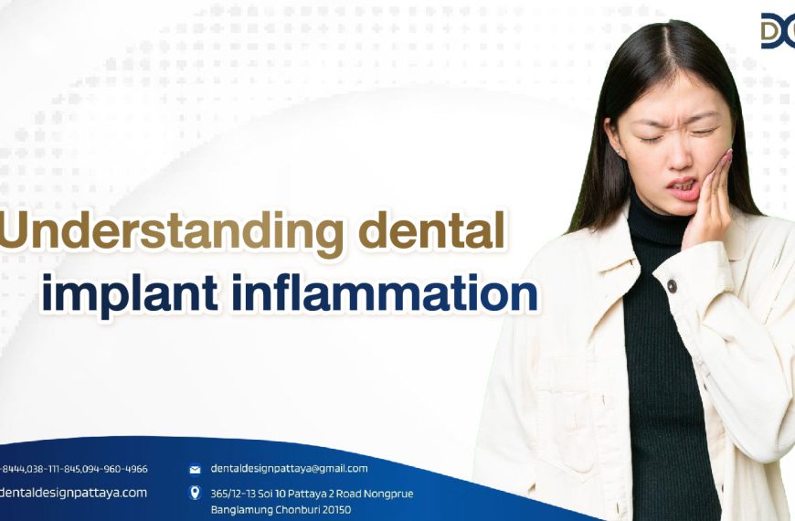 Understanding dental implant inflammation