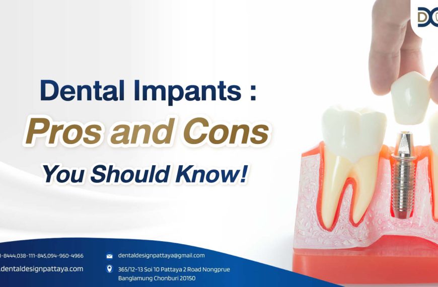 cover - Dental Implants: Pros and Cons You Should Know!