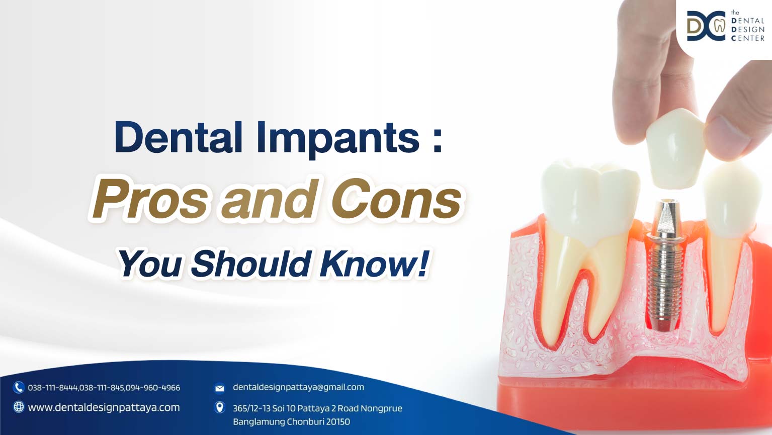 cover - Dental Implants: Pros and Cons You Should Know!