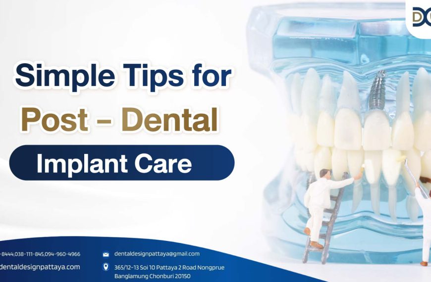 Cover Simple Tips for Post-Dental Implant Care