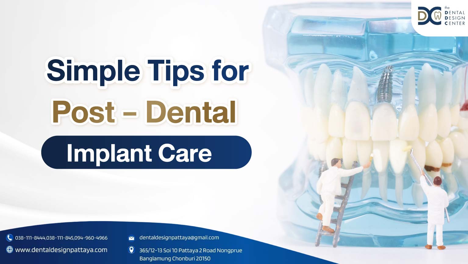 Cover Simple Tips for Post-Dental Implant Care