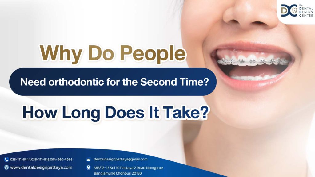 COVER-Why Do People Need orthodontic for the Second Time? How Long Does It Take?