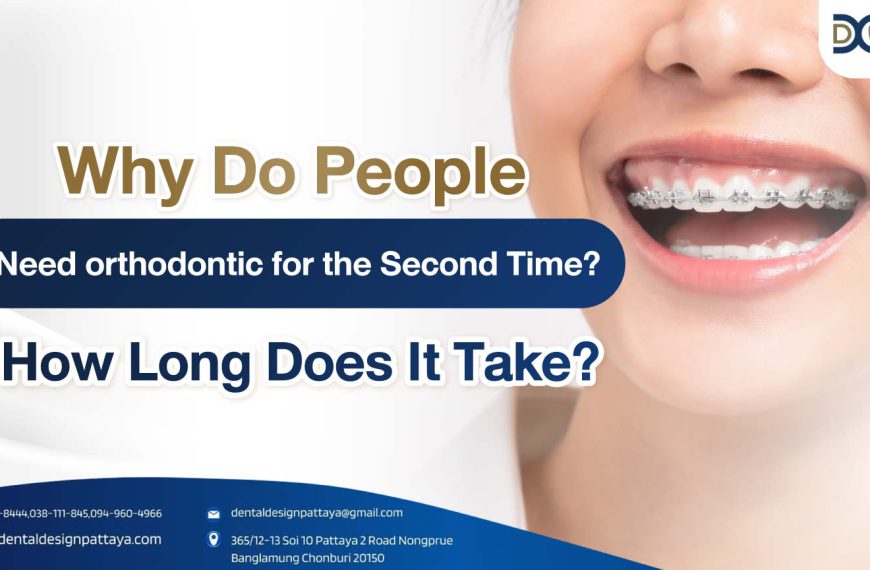 COVER-Why Do People Need orthodontic for the Second Time? How Long Does It Take?