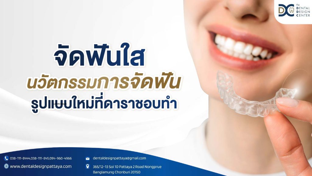 จัดฟันใส นวัตกรรมการจัดฟันรูปแบบใหม่ที่ดาราชอบทำ