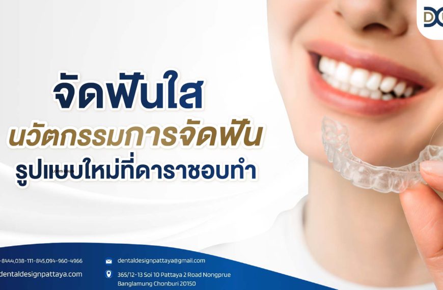 จัดฟันใส นวัตกรรมการจัดฟันรูปแบบใหม่ที่ดาราชอบทำ