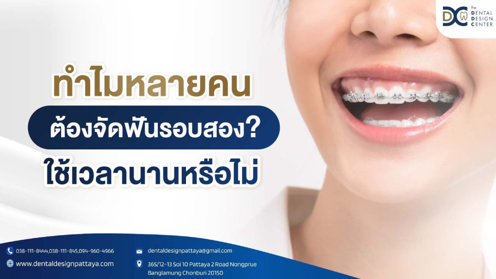 ทำไมหลายคนต้องจัดฟันรอบสอง? ใช้เวลานานหรือไม่