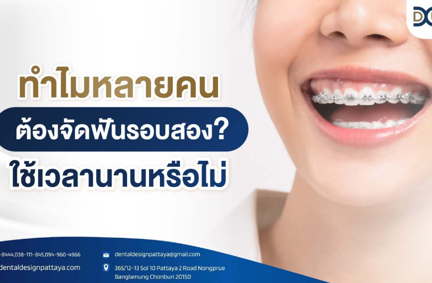 ทำไมหลายคนต้องจัดฟันรอบสอง? ใช้เวลานานหรือไม่