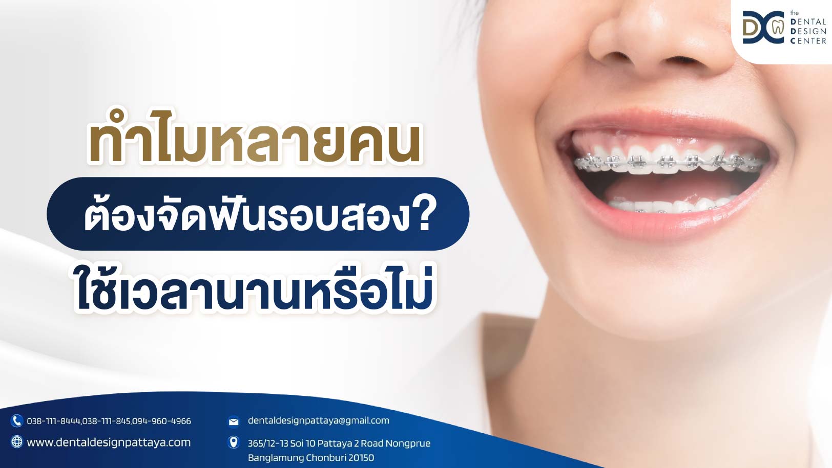 ทำไมหลายคนต้องจัดฟันรอบสอง? ใช้เวลานานหรือไม่