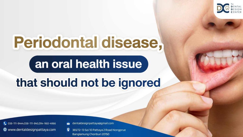 Periodontal diseas